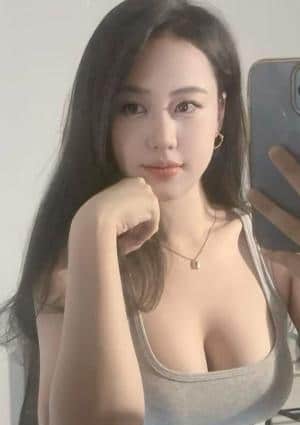 べトちゃん20代 アリスちゃん