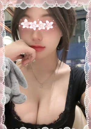 べトちゃん20代 みあちゃん