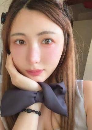 カルミア ななちゃん