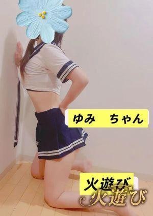 火遊び ゆみ