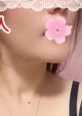 楽（らく） みみちゃん