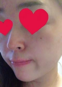 出張専門いまきゅれ～と ちか